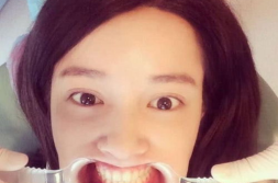 娱乐圈吃瓜张大奕,揭秘张大奕的明星生活与争议风波